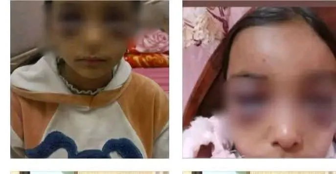 «الأب مسافر».. زوجة أب تعذب طفلتين بالشرقية لإجبارهما على أعمال المنزل